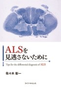ALSを見逃さないために_アイキャッチ画像（W213×自動）